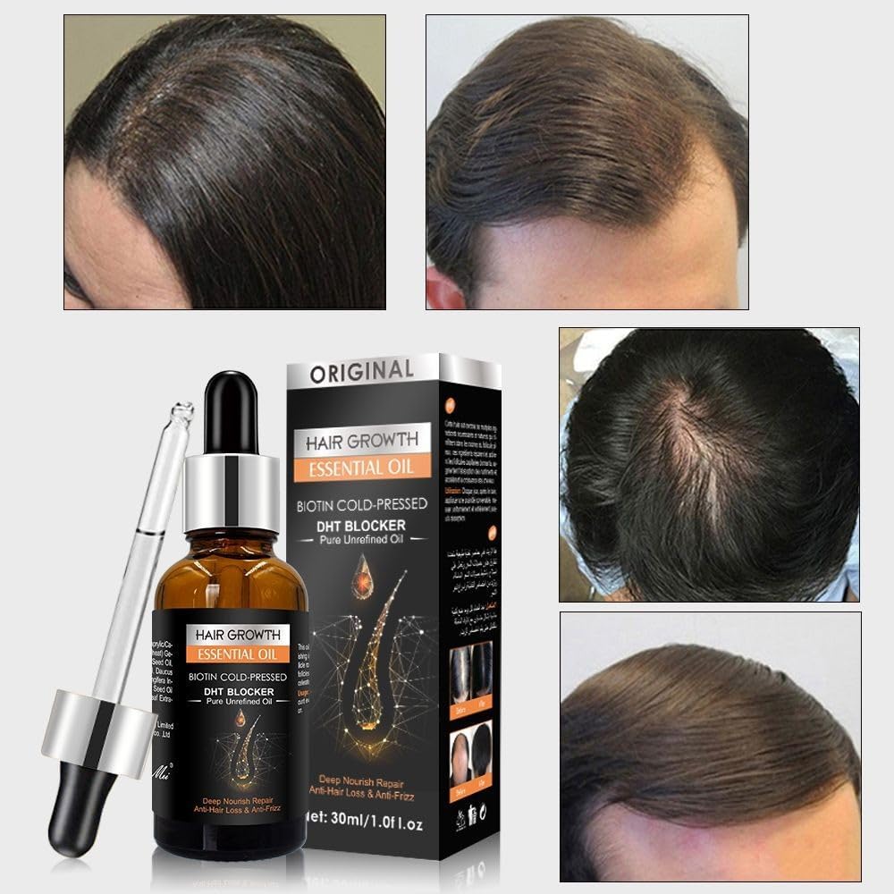Hair Growth Essential Oil 30ml