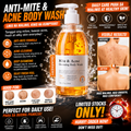 Mite & Acne Cleansing Body Wash 250ml