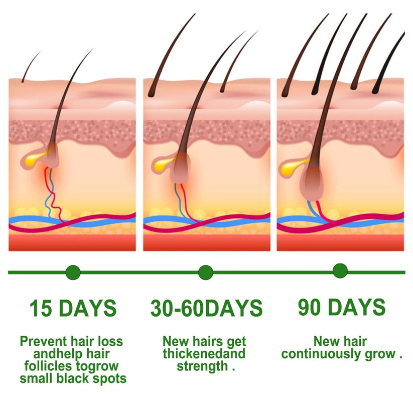 EELHOE Rosemary Hair Growth Essential Oil