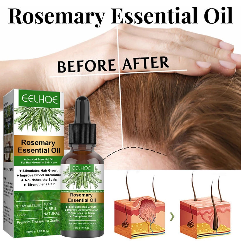 EELHOE Rosemary Hair Growth Essential Oil