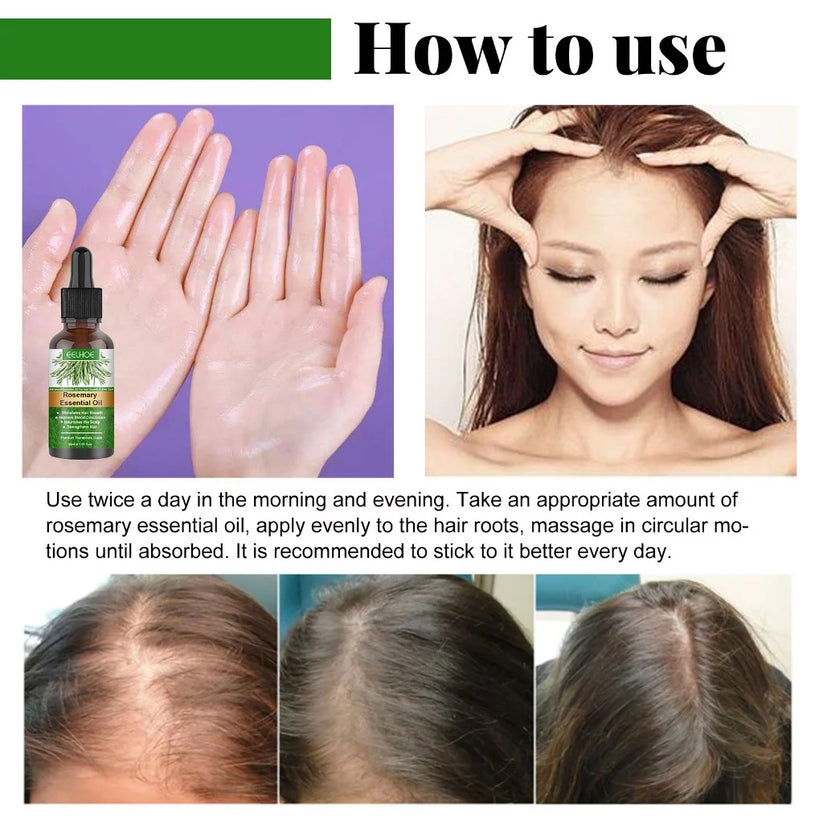 EELHOE Rosemary Hair Growth Essential Oil