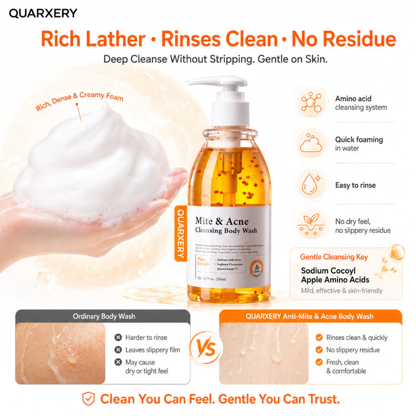 Mite & Acne Cleansing Body Wash 250ml