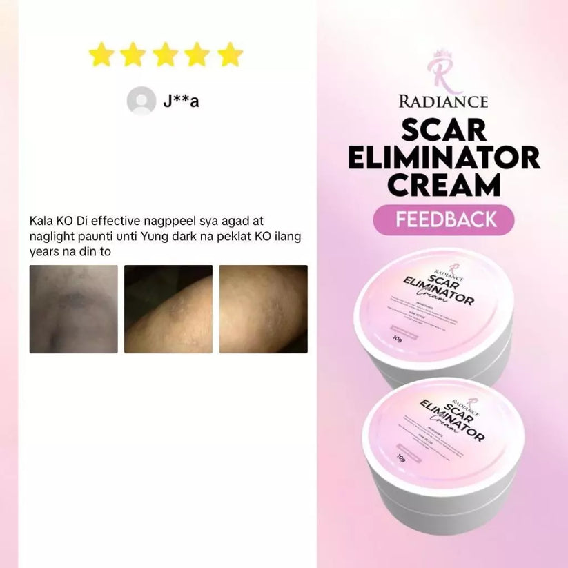 RADIANCE Scar Eliminator Cream 10g