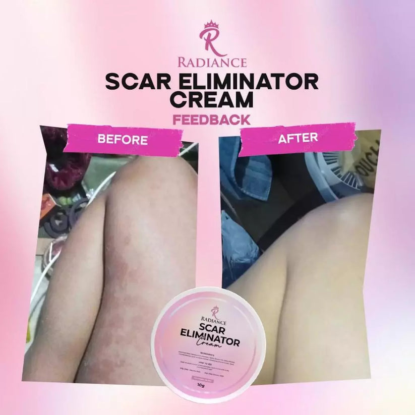 RADIANCE Scar Eliminator Cream 10g