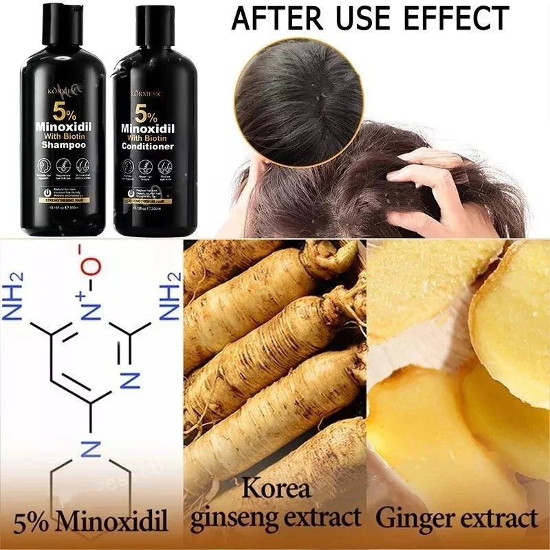 KORMESIC 5% Minoxidil with Biotin Shampoo 300ml