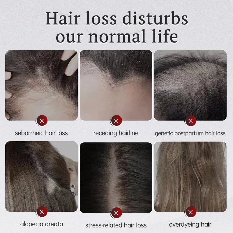 Hair Growth Essential Oil 30ml