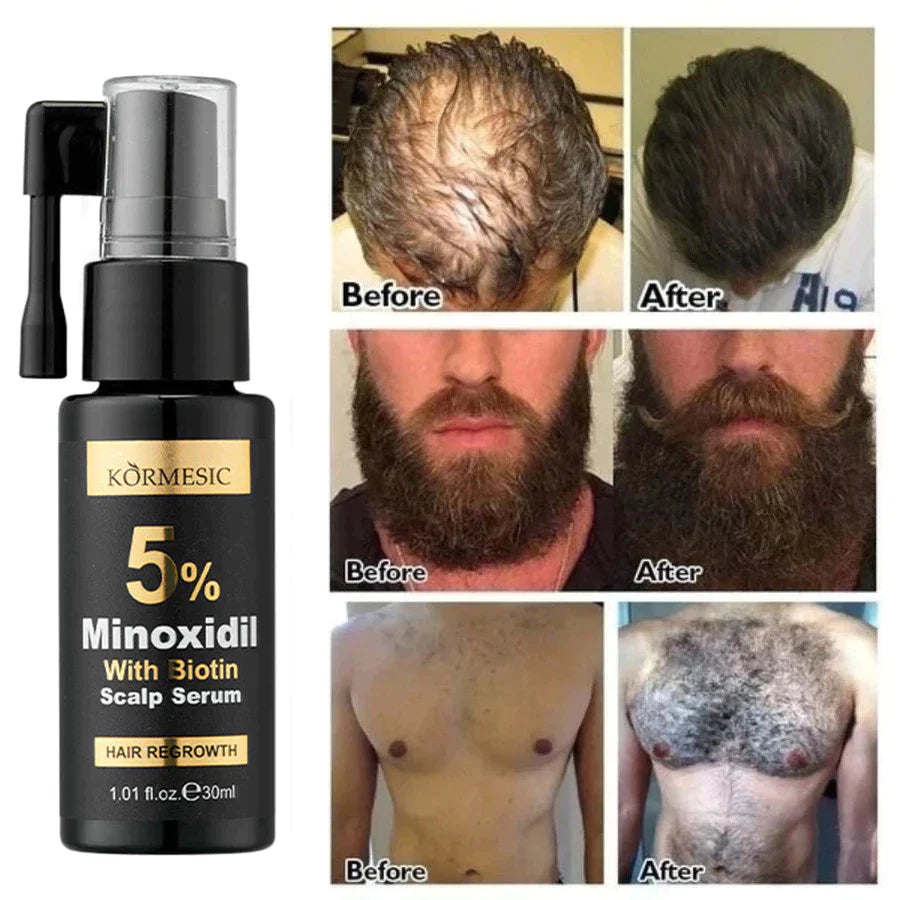KORMESIC Minoxidil 5% with Biotin Scalp Serum & Massage Cream Set