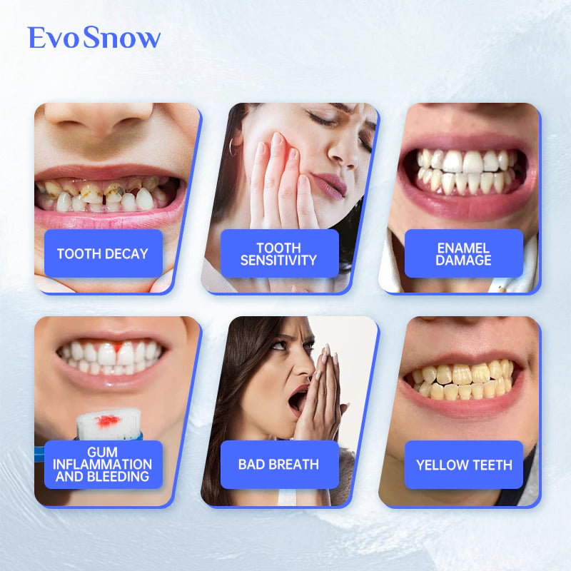 EvoSnow 10% HAP Toothpaste 100g Blueberry Mint