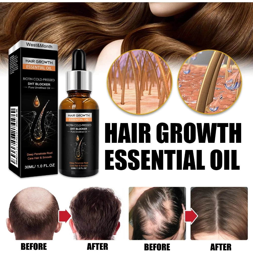 Hair Growth Essential Oil 30ml