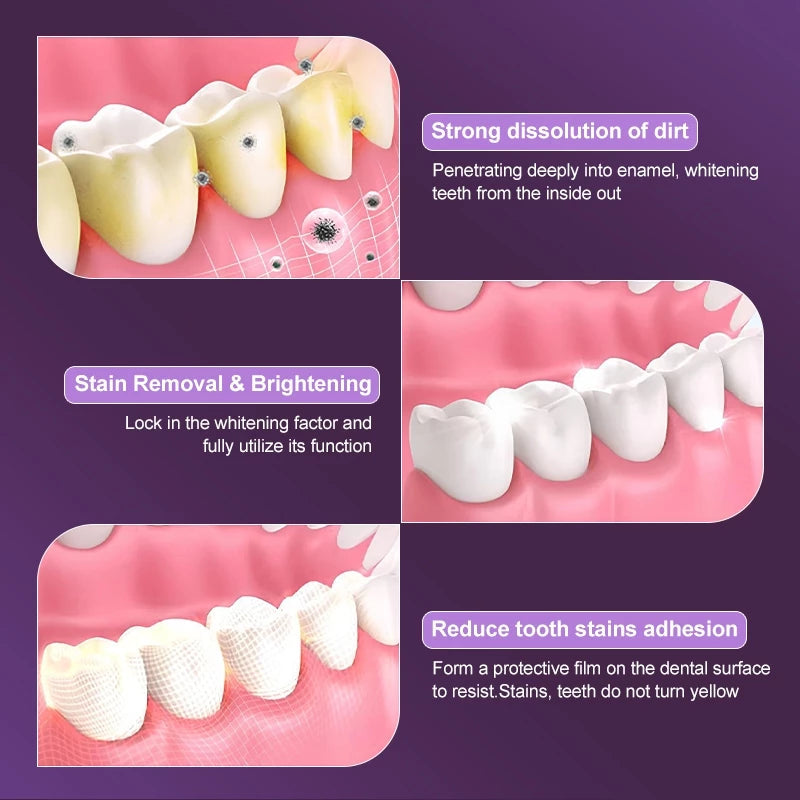 V34 Teeth Whitening Strips