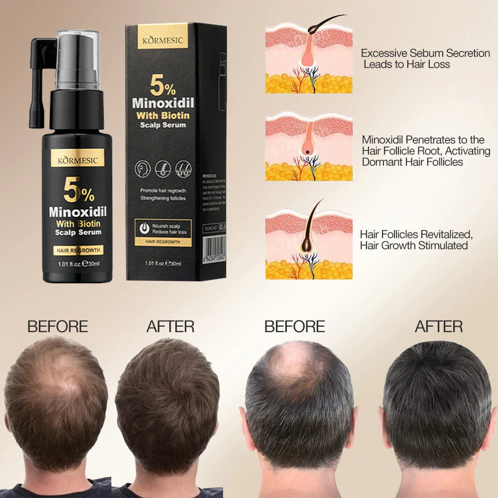 KORMESIC Minoxidil 5% with Biotin Scalp Serum & Massage Cream Set