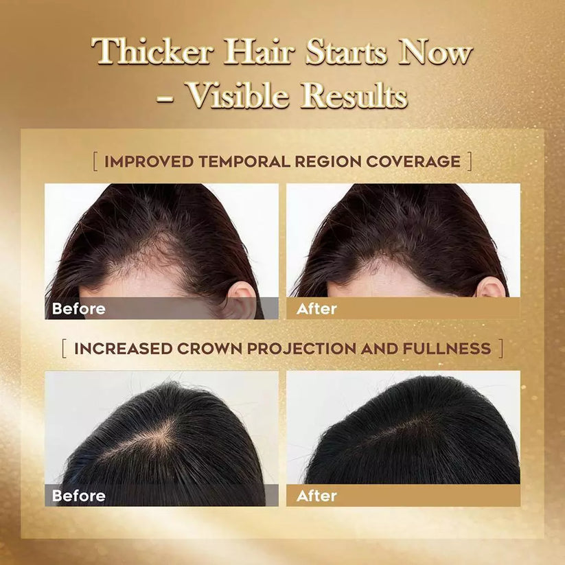 LUMÉI Rosemary Infused Hair Growth Support Serum